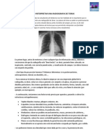 Como Inter Pre Tar Una Radiografia de Torax