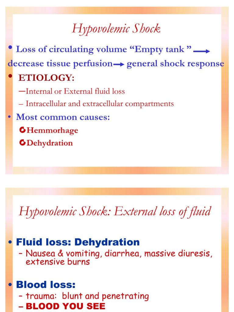 Types Of Shock