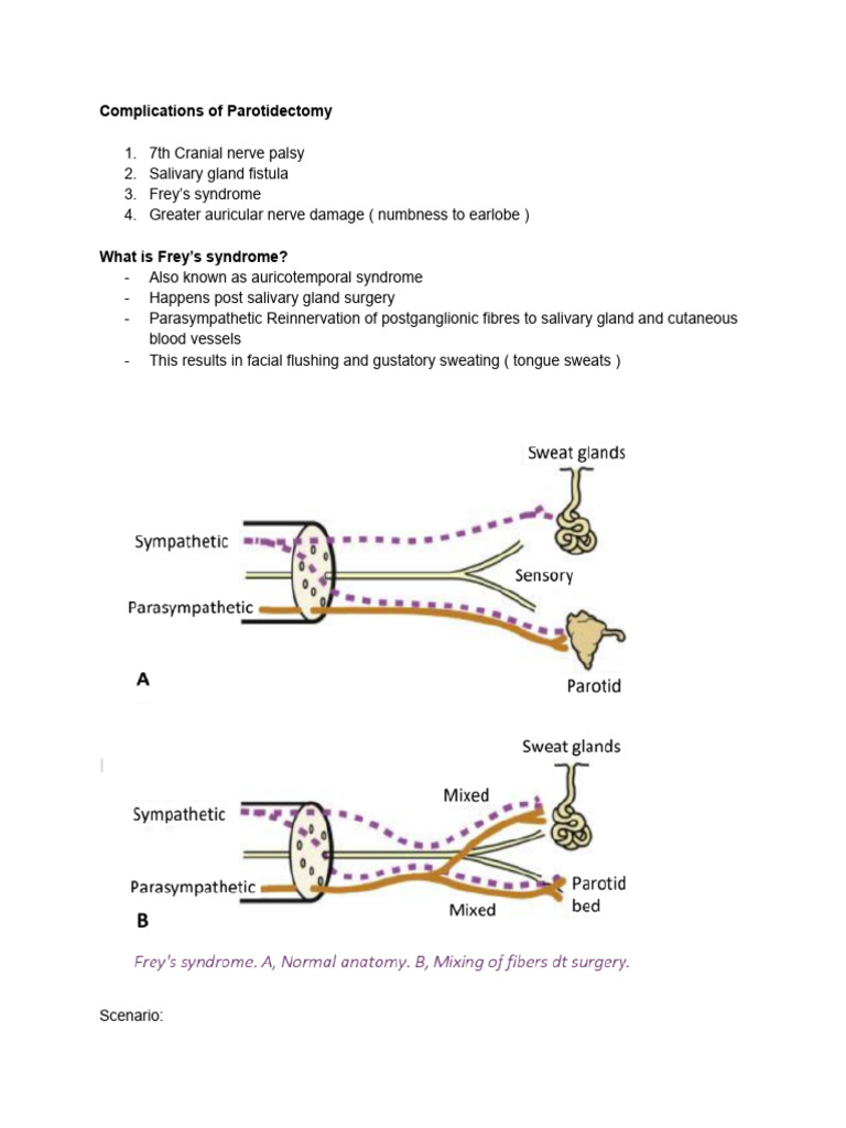 Parotidectomy | PDF