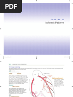 Understanding RWMA in Echocardiography | PDF | Ventricle (Heart ...