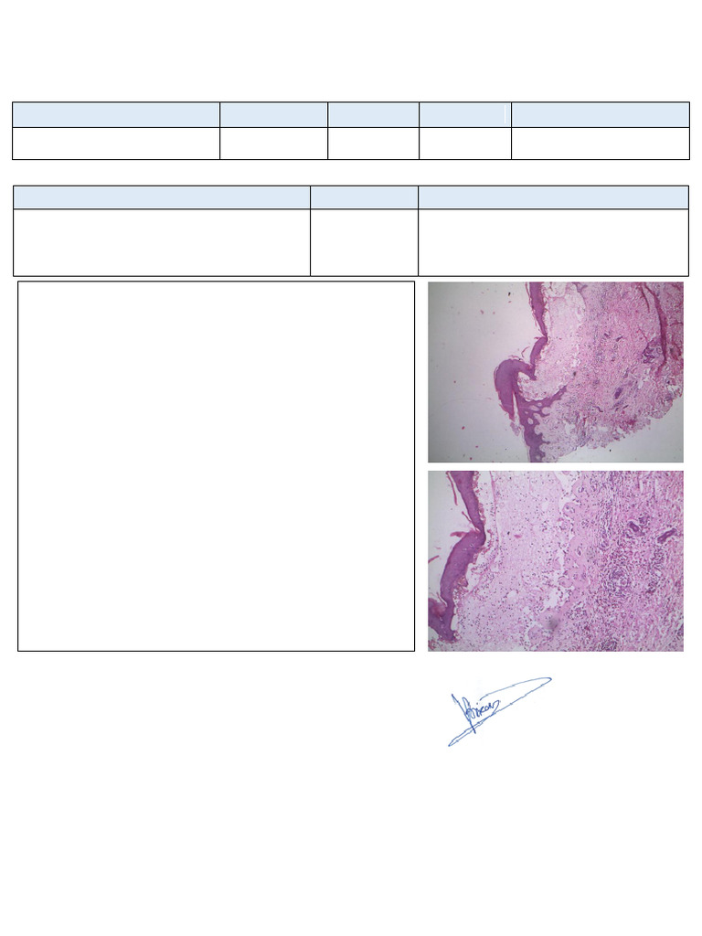 np2201-bullous-pemphigoid-pdf