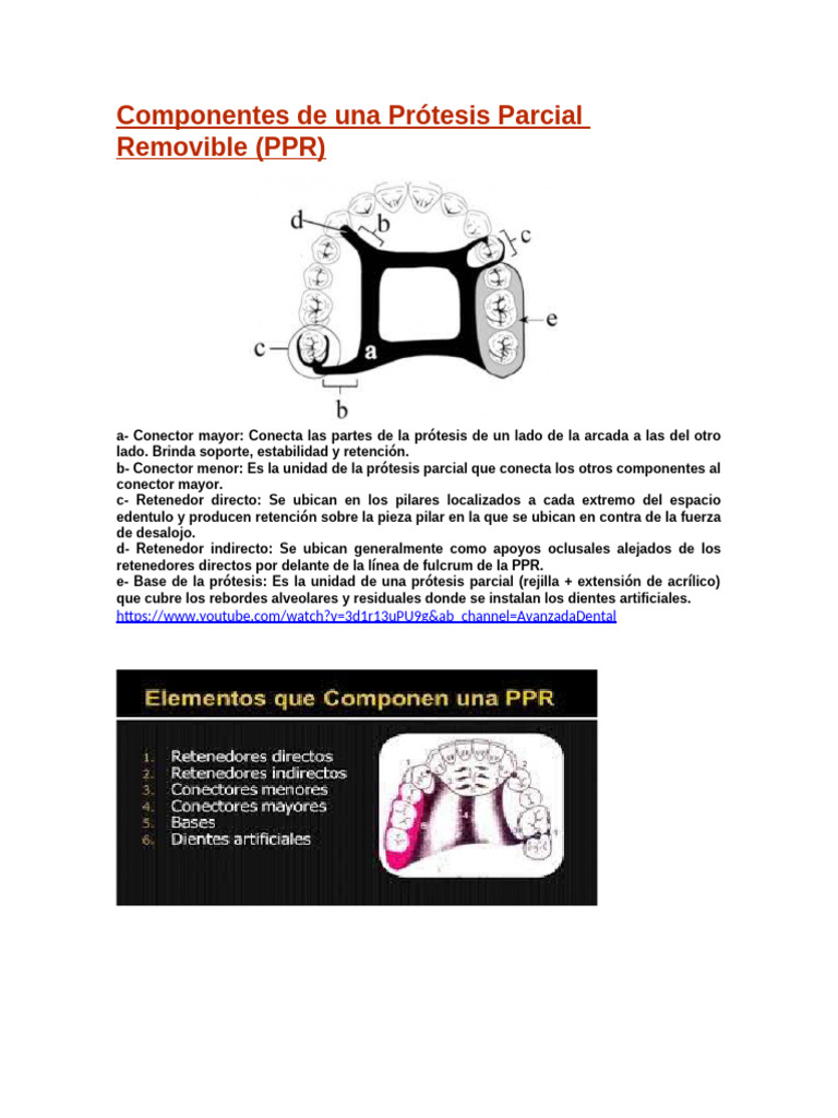 Componentes de Prótesis Parcial Removible | PDF | Ramas de Odontología ...
