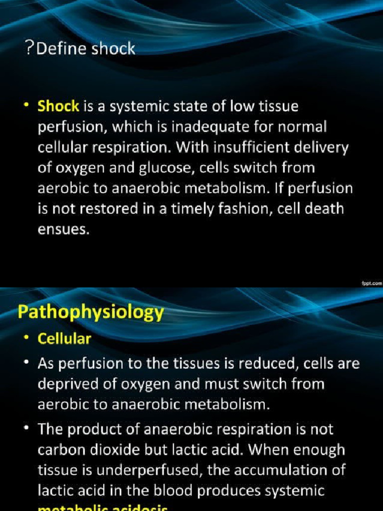 Shock | PDF