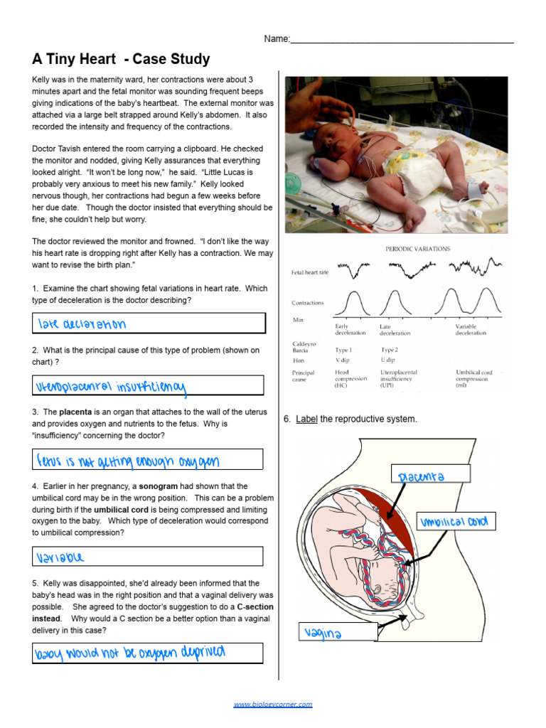 Case+Study+ +a+Tiny+Heart+ | PDF | Heart | Ventricle (Heart)