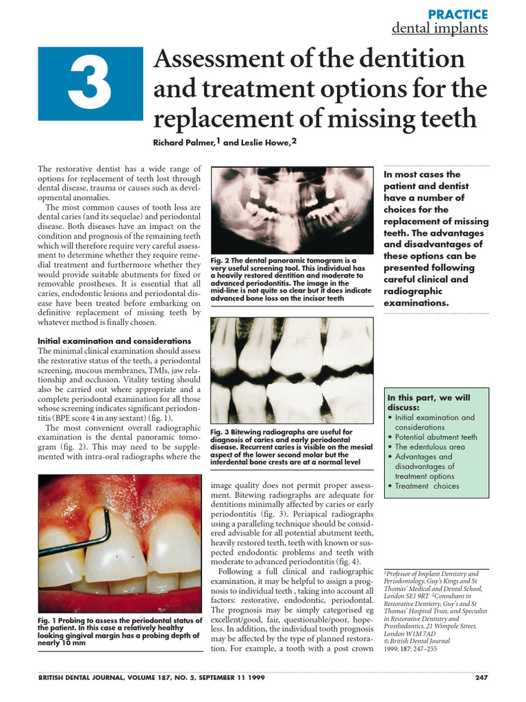 Dental Treatment Options for Implants | PDF | Dental Implant | Human Tooth