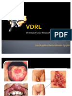 VDRL2