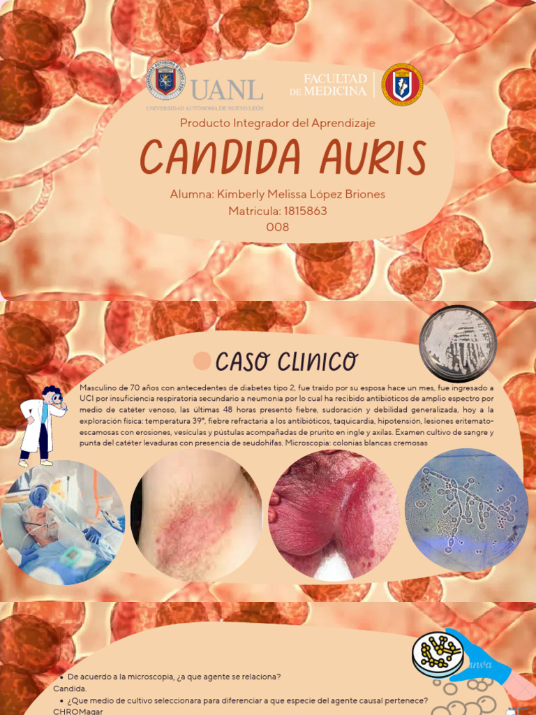 Candidemia por Candida auris en paciente anciano | PDF | Ciencias de la ...