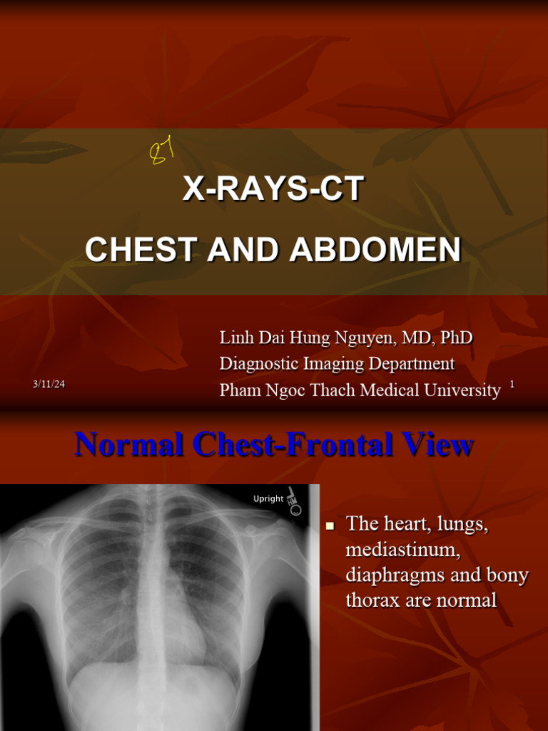 Chest and Abdomen X-Ray Analysis | PDF | Thorax | Clinical Medicine
