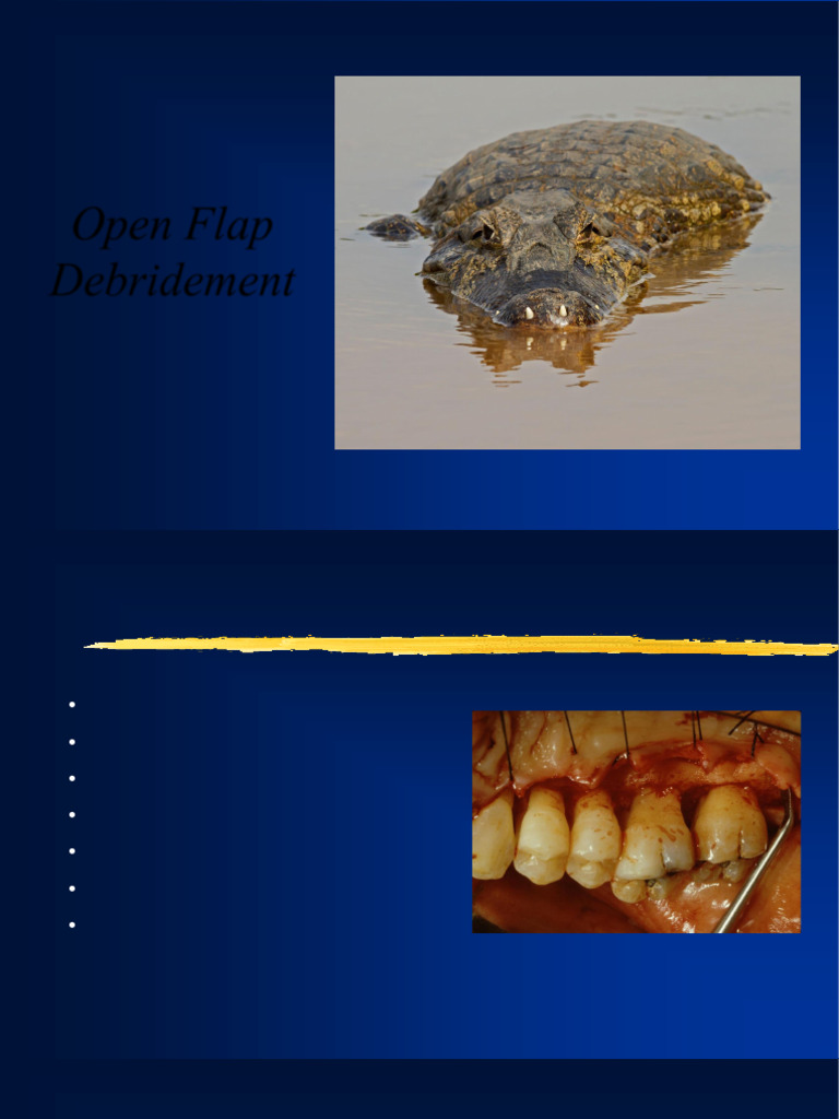 Open Flap Debridement Techniques | PDF | Periodontology | Medical ...