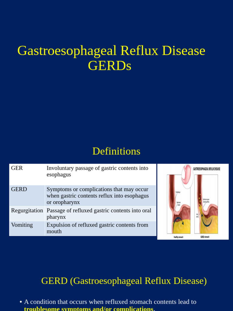 Therapiutic GERD | PDF | Gastroesophageal Reflux Disease | Esophagus