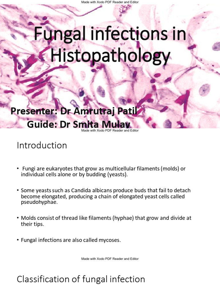 Fungal Infections in Histopathology-EDIT | PDF | Candidiasis | Clinical ...