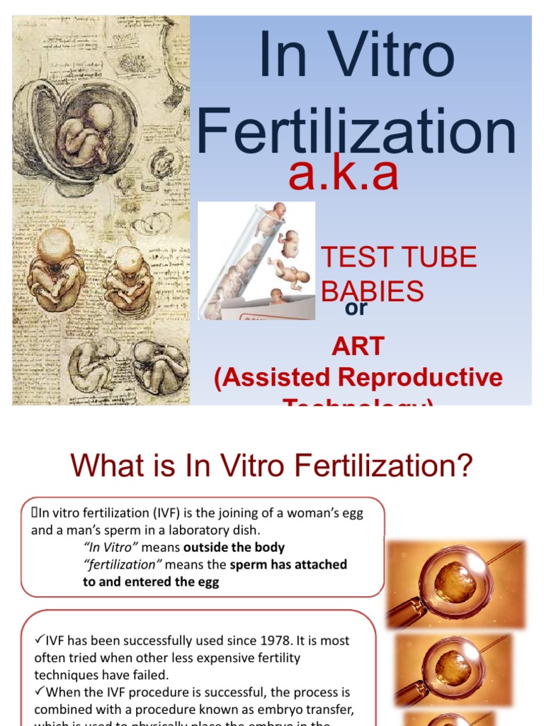 Understanding In Vitro Fertilization | PDF | In Vitro Fertilisation ...