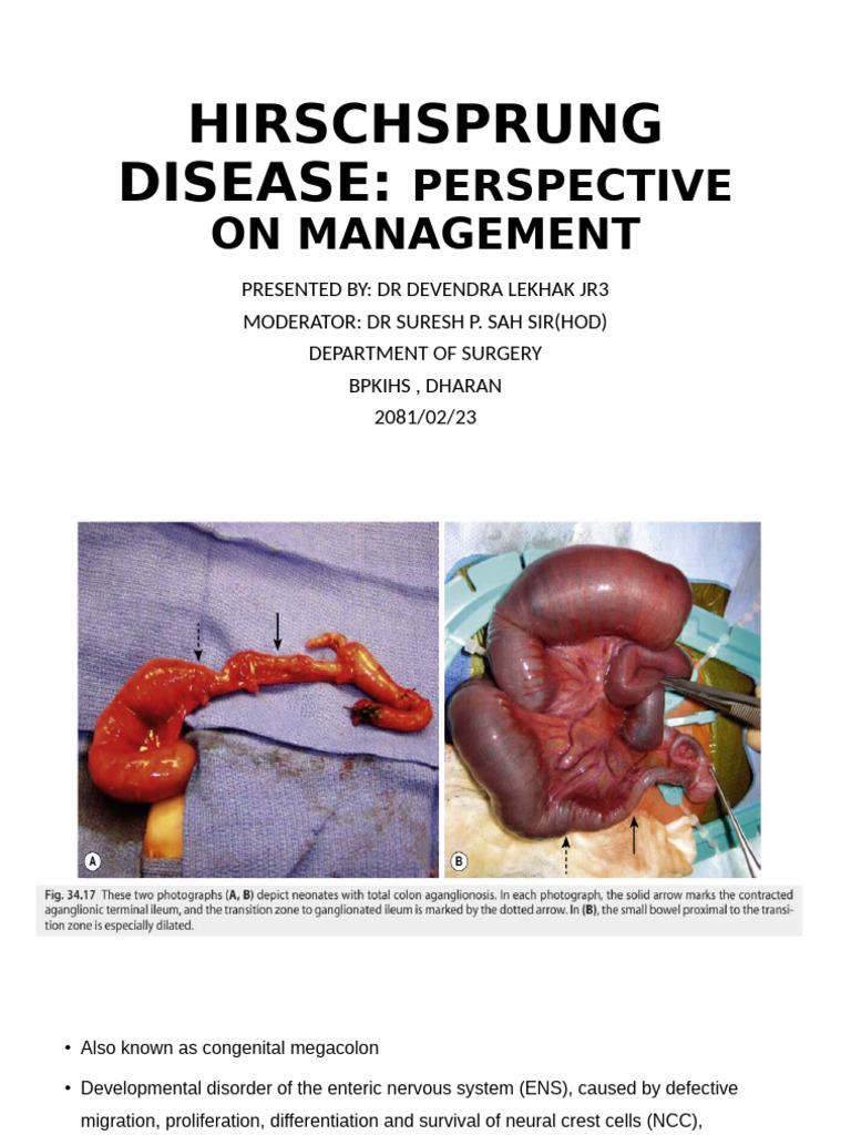 Hirsch Sprung | PDF | Rectum | Constipation