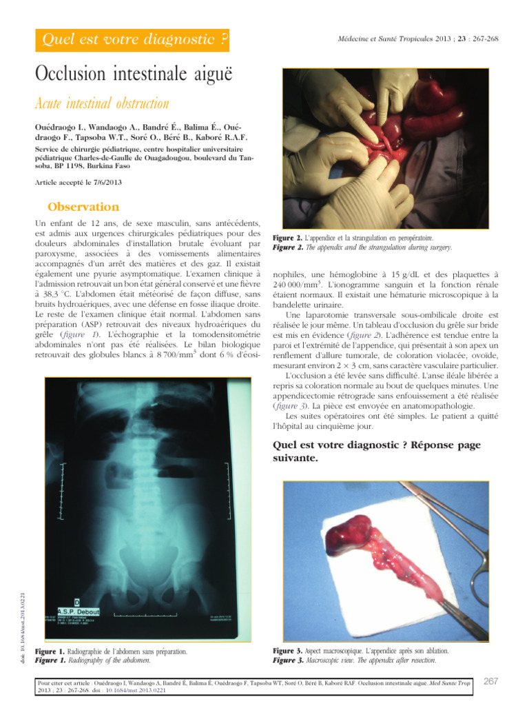 Occl Intestinale Aigue | PDF | Spécialités médicales | Médecine clinique