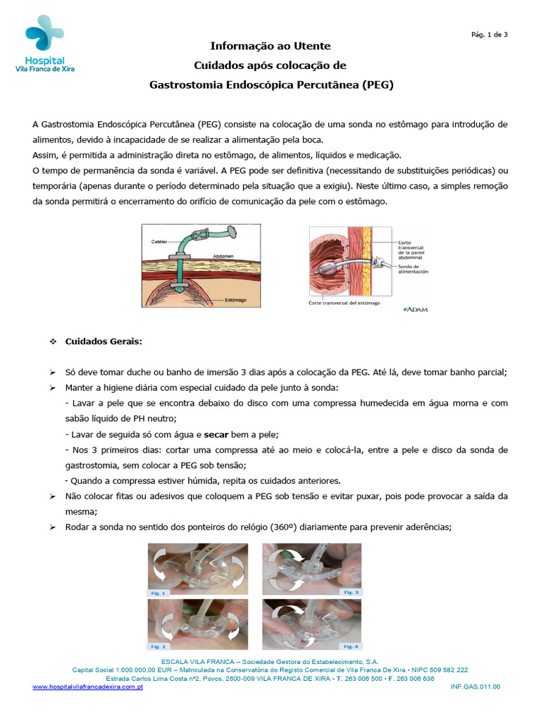 Cuidados à PEG | PDF | Alimentos