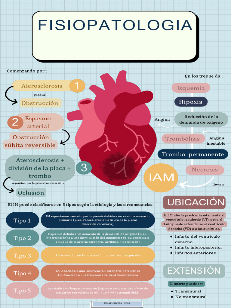 Fisiopatología del Infarto Agudo al Miocardio | PDF | Infarto de ...