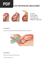 Forceps Delivery: Procedure and Steps | PDF | Childbirth | Clinical ...
