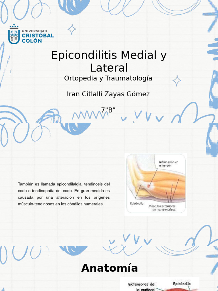 Epicondilitis Medial y Lateral | PDF | Codo | Causas de la muerte