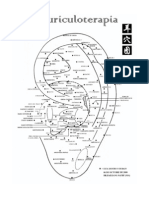 auriculoterapia