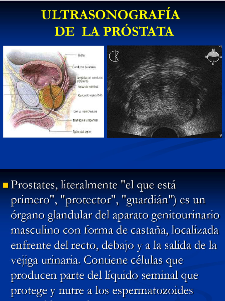Ecografía de Próstata: Guía Completa | PDF | Cáncer | Próstata