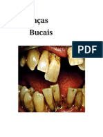 Trabalho Doenças Bucais