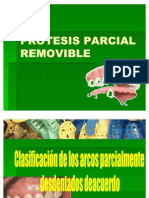 Protesis parcial removible: clasificación Kennedy-Applegate