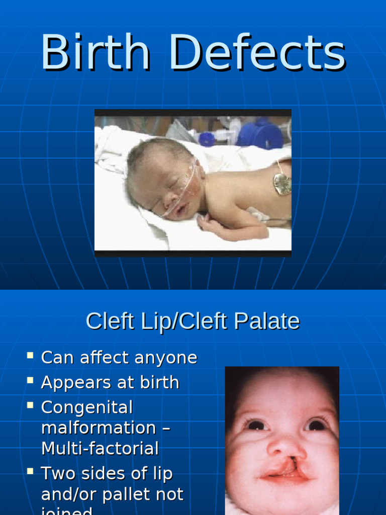 S3O1BirthDefects2 | PDF | Congenital Disorder | Diseases And Disorders