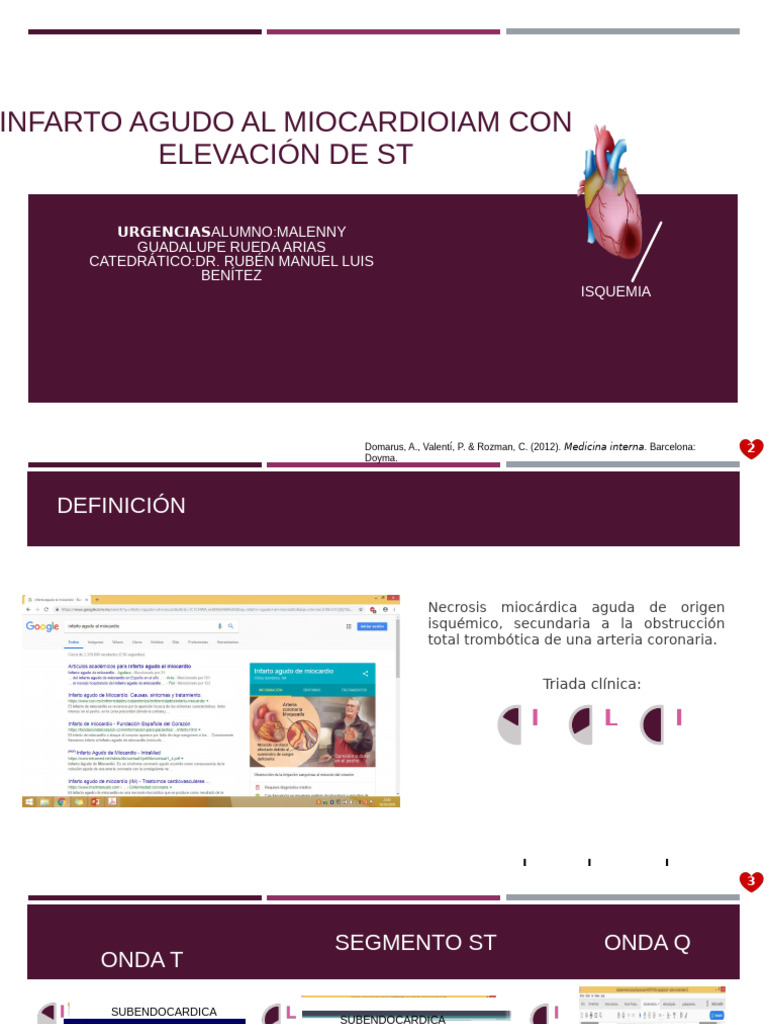 Para Subir | PDF | Electrocardiografia | Infarto de miocardio