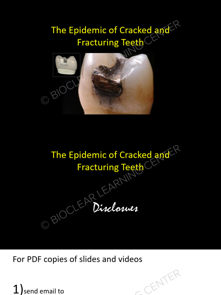 Yankee 2020 Cracked Tooth Lecture and Modern Preps PDF-s | PDF ...