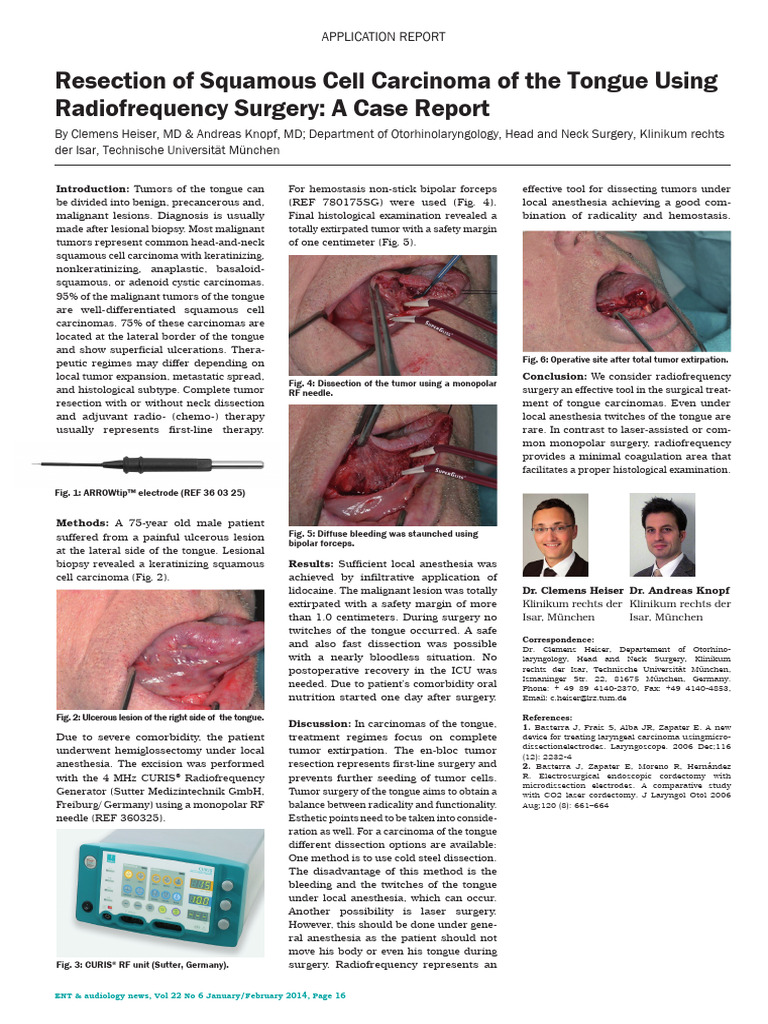 SUTTER Application Report DR - Heiser - ENT News Jan+Feb 2014 | PDF ...