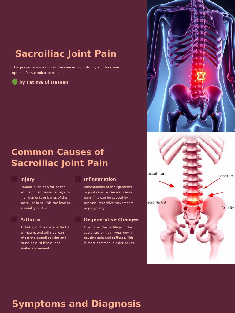 SACROILIAC JOINT PAIN intelligence overview