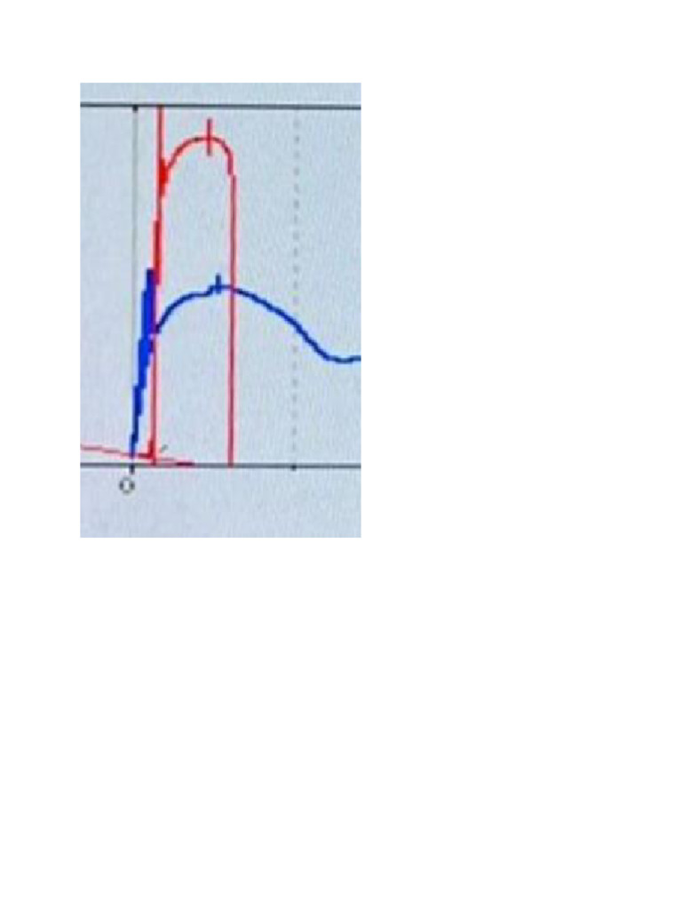 Graph | PDF