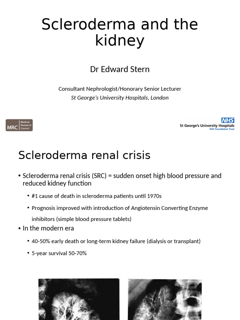 Scleroderma Renal Crisis Insights | PDF | Chronic Kidney Disease | Kidney