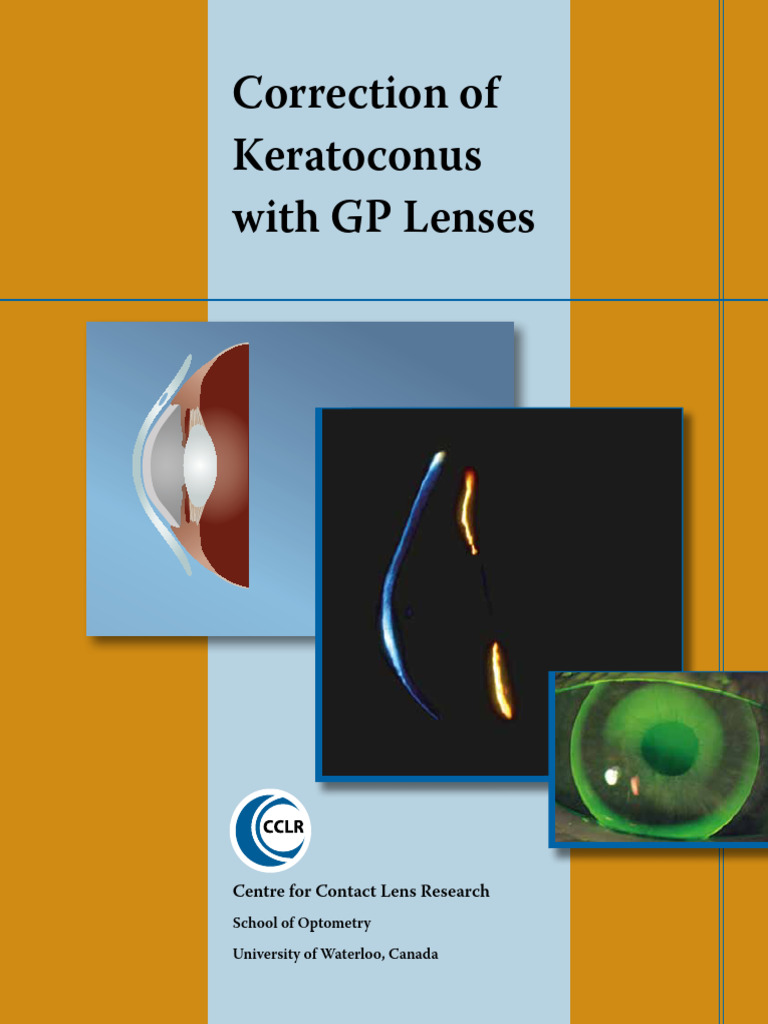 Correction Of Keratoconus En Pdf Contact Lens Eye