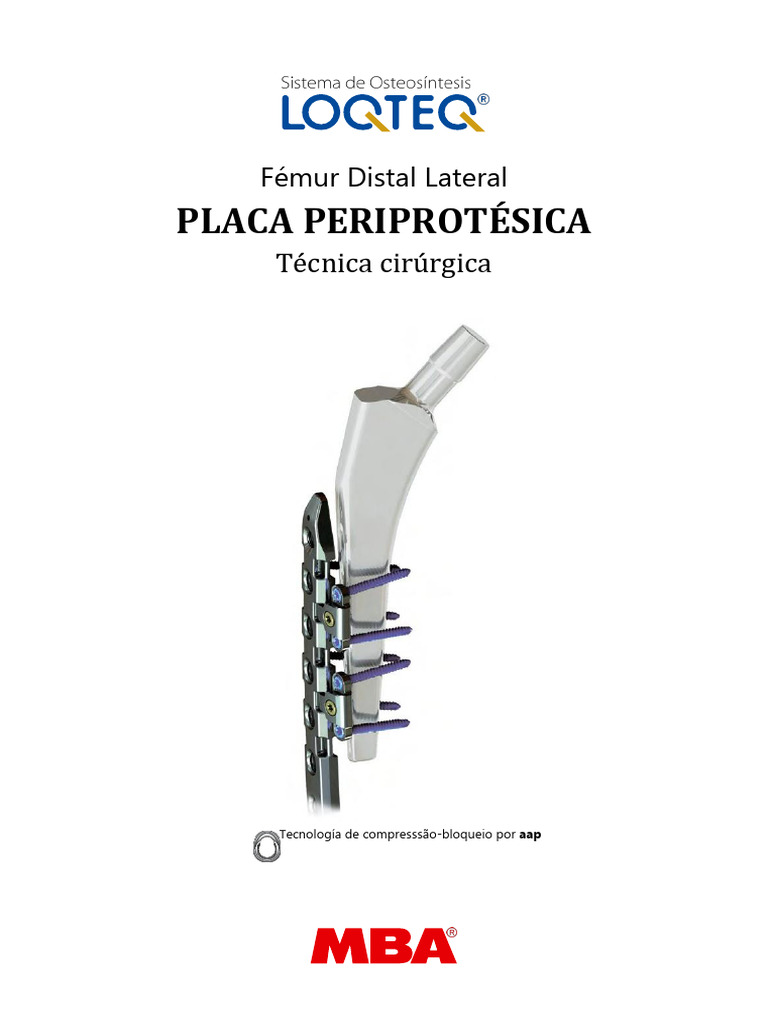 HASTE FEMORAL, image size:768x1024