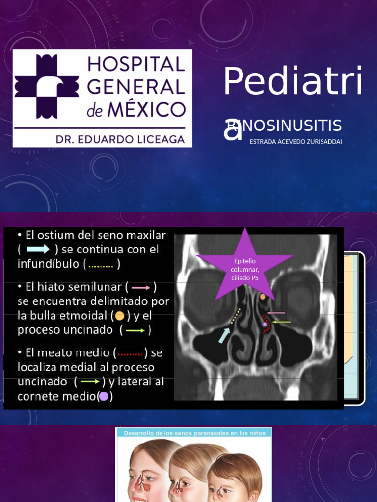 Sinusitis | PDF | Estadísticas medicas | Ciencias de la Salud
