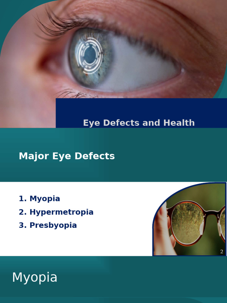 Understanding Major Eye Defects | PDF | Myopia | Visual Impairment