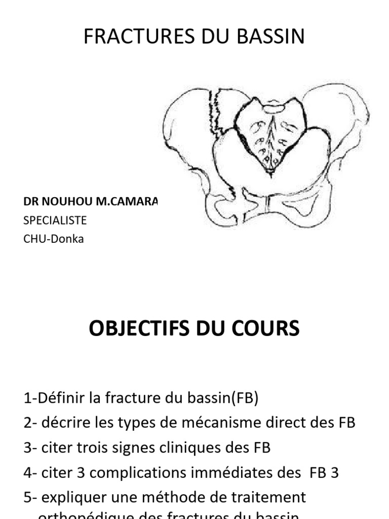 Fractures du bassin : traitement et classification | PDF | Appareil ...