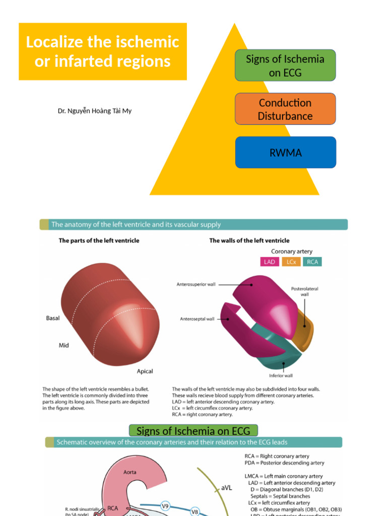 ECG Ischemia & RWMA Guide | PDF