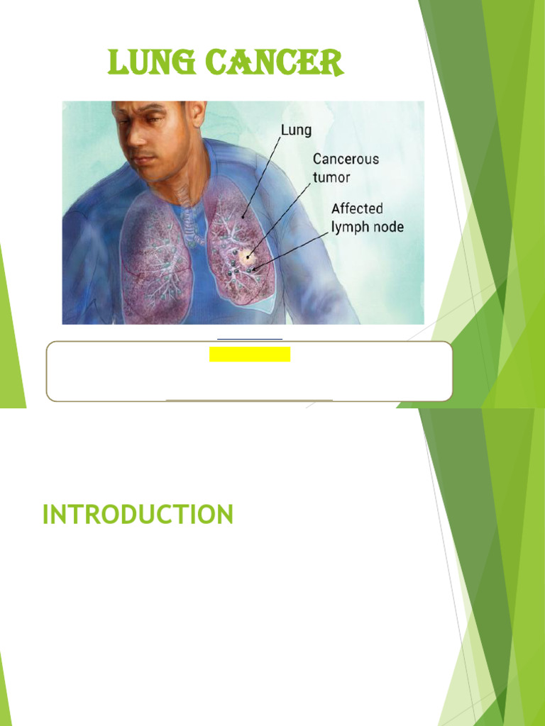 Lung cancer | PDF | Lung Cancer | Cancer