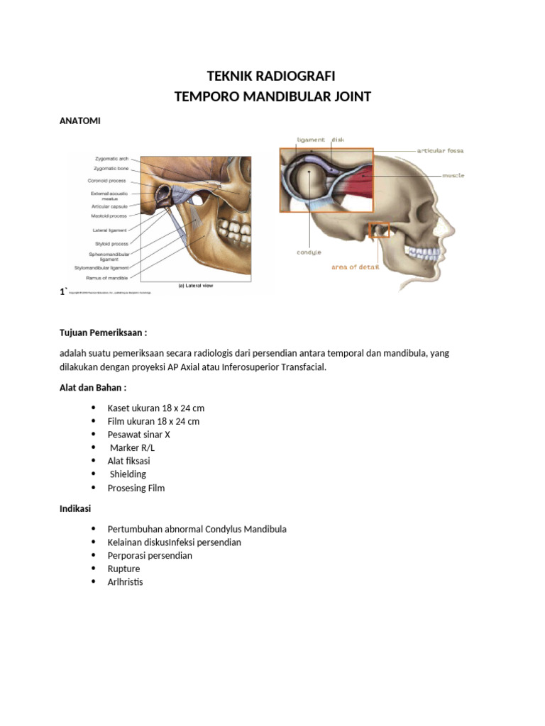 Teknik Radiografi TMJ dan Mandibula | PDF