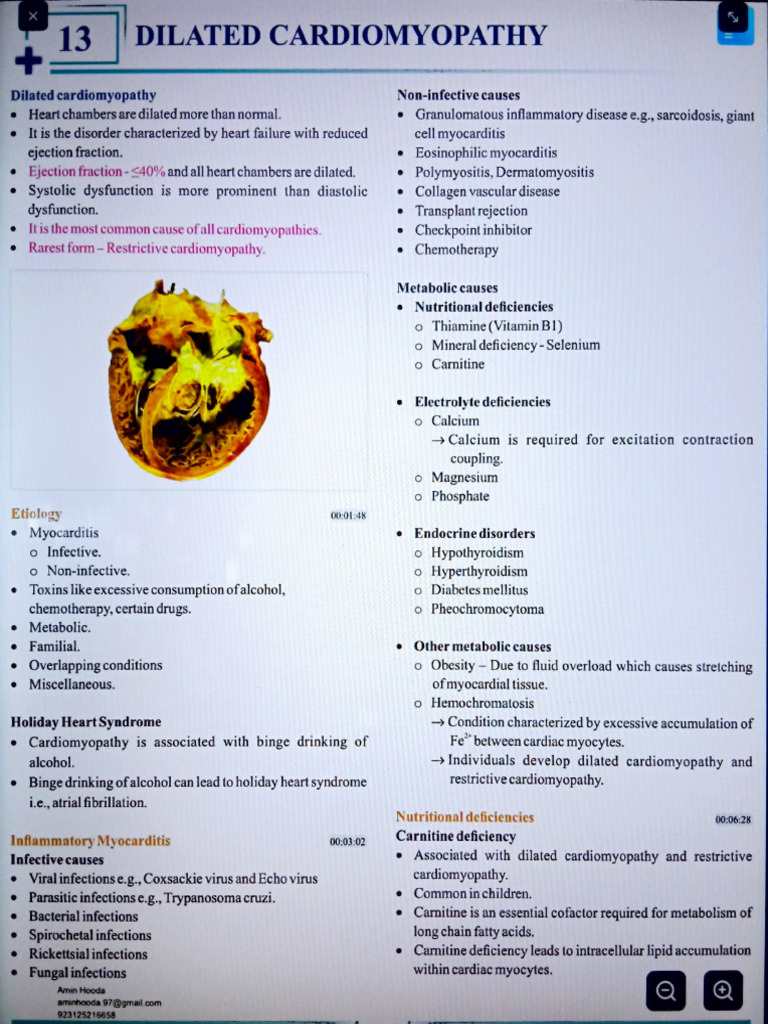 Dilated Cardiomyopathy | PDF