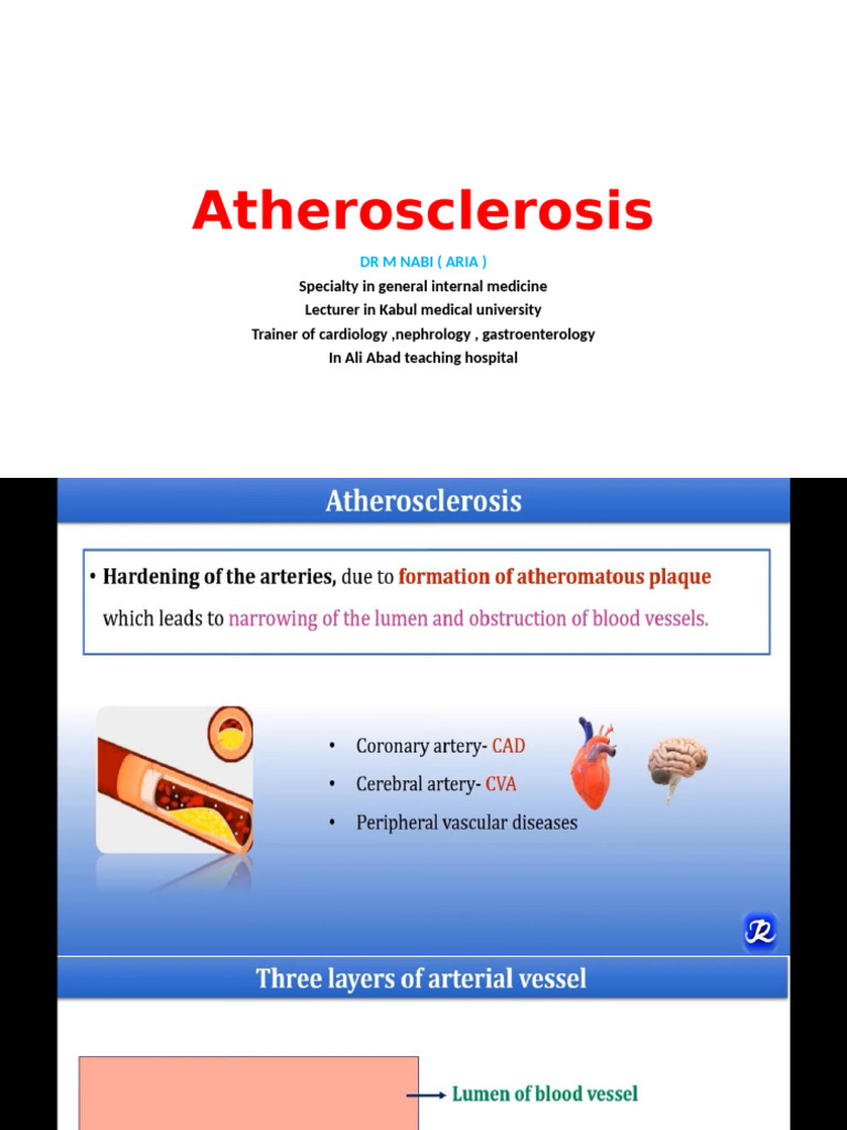 Atherosclerosis Overview by Dr. M Nabi | PDF