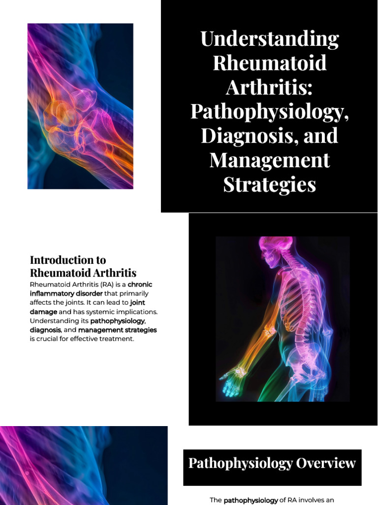 Understanding Rheumatoid Arthritis Pathophysiology Diagnosis and ...