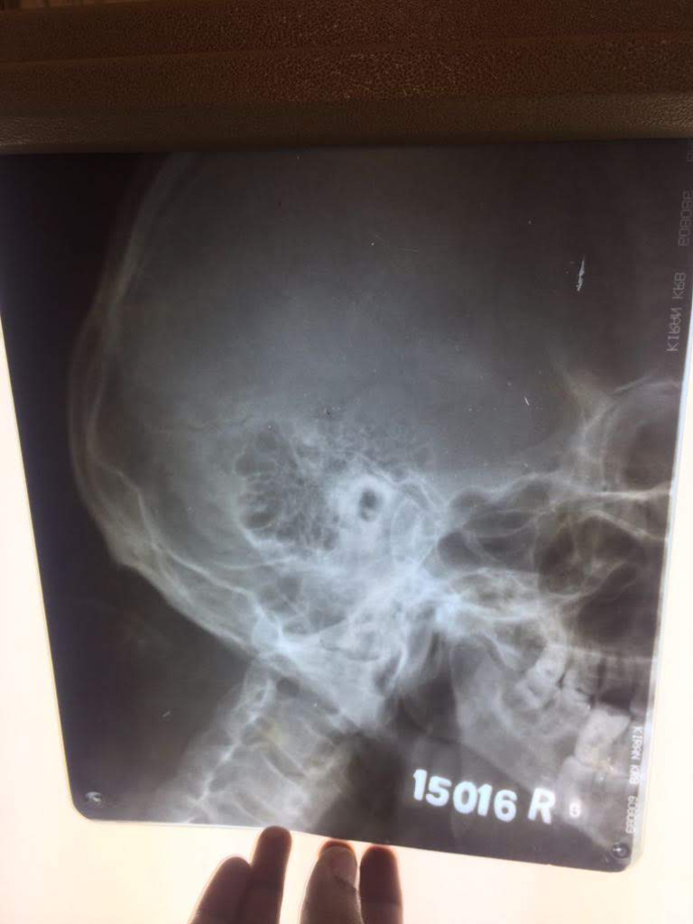 Ent Xrays | PDF