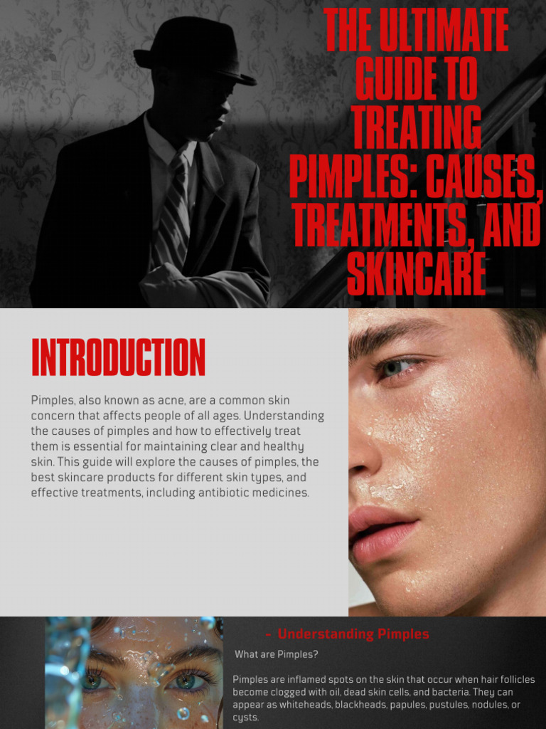 The Ultimate Guide To Treating Pimples Causes, Treatments, and Skincare ...