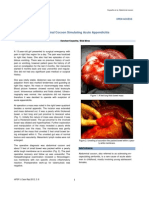 Abdominal Cocoon Simulating Acute Appendicitis