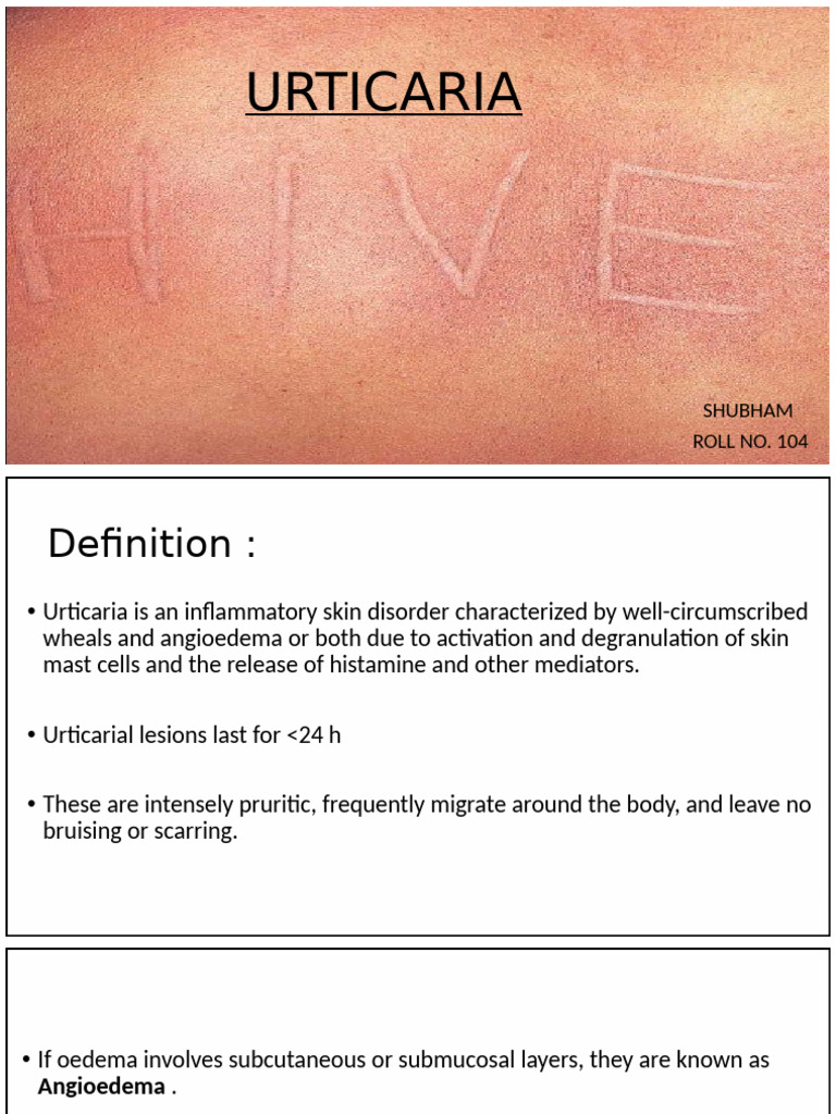 Urticaria | PDF | Immune System Disorders | Medical Specialties