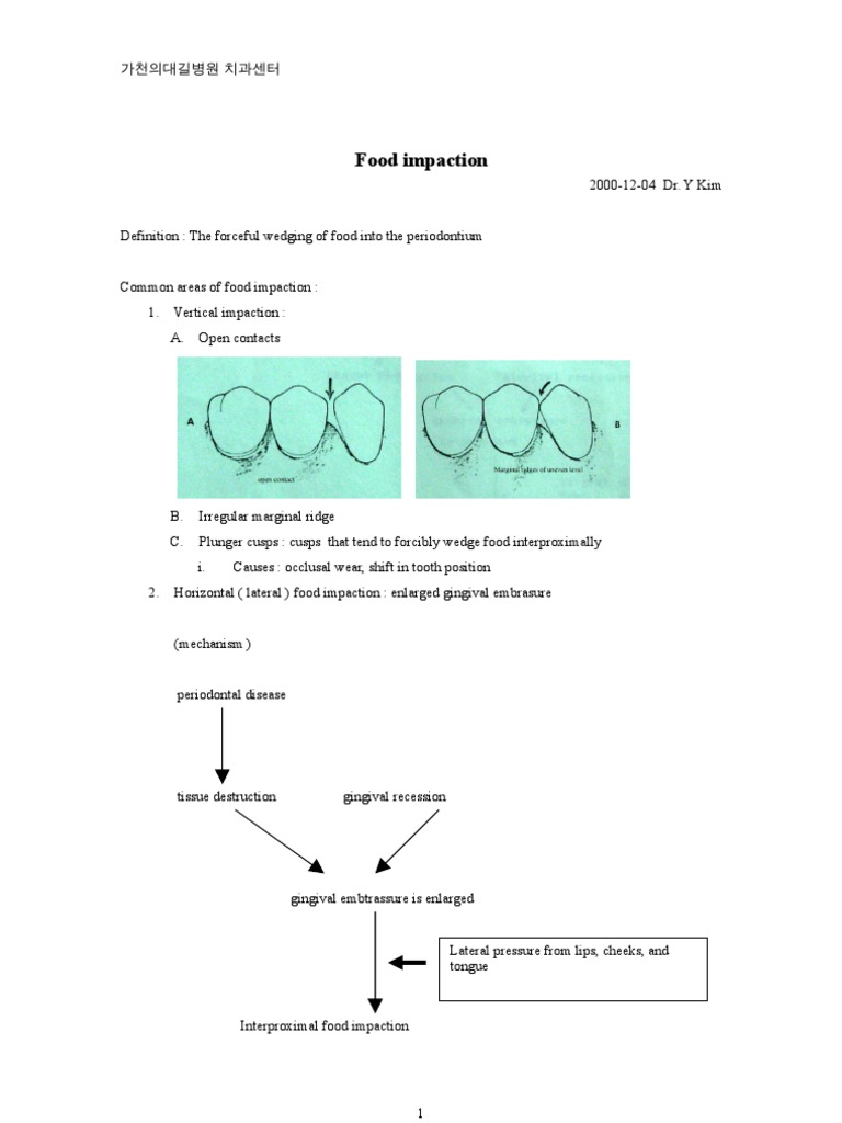 Food Impaction PDF Human Head And Neck Clinical Medicine