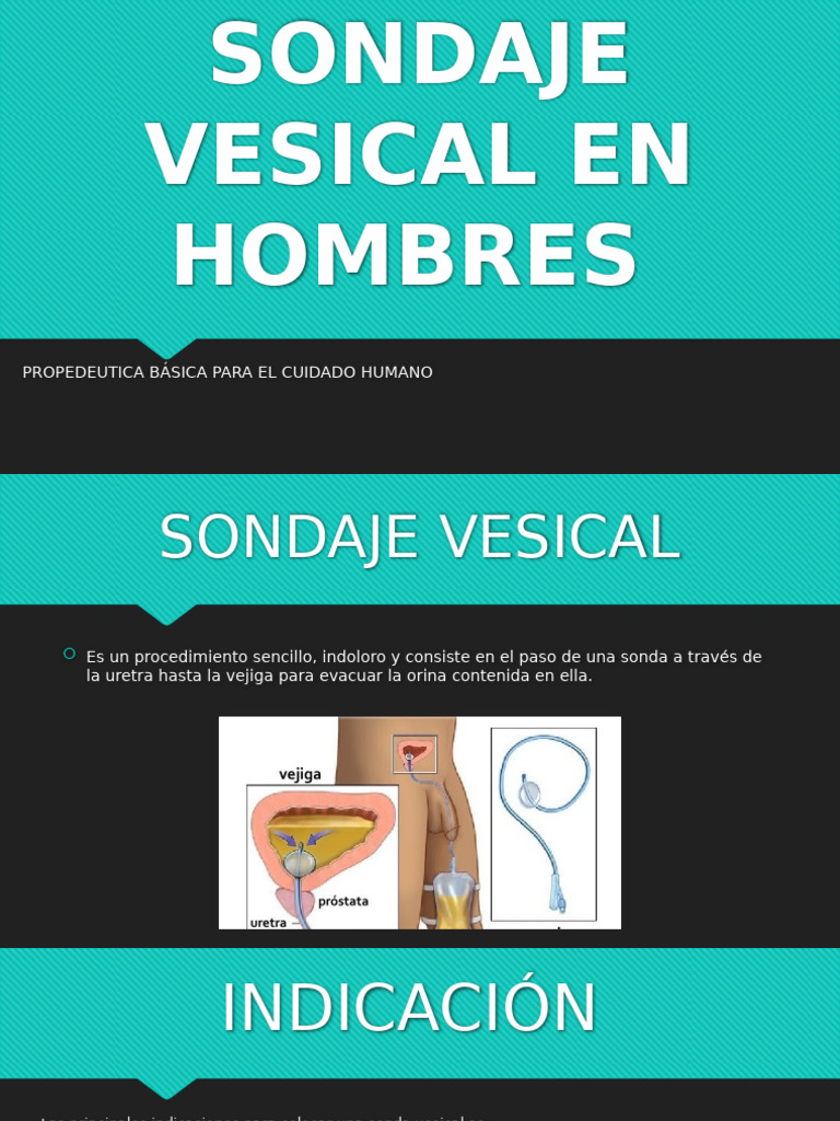 Sondaje Vesical en Hombres: Procedimiento y Cuidados | PDF | Urología ...